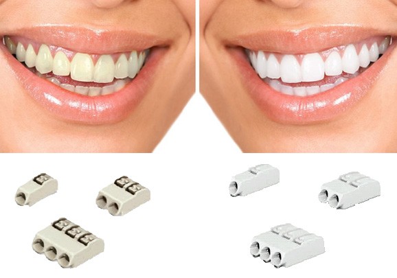 FUN but REAL: Biele zuby sú krajšie ako svetlosivé – to isté platí pre svorkovnice